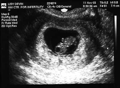 Our worst fears are true