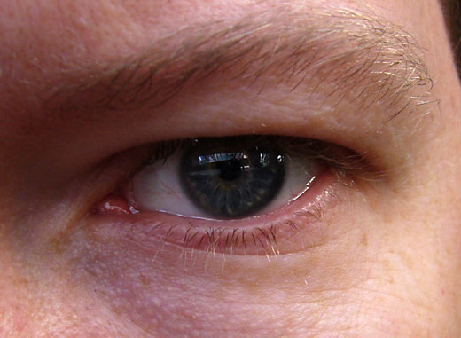 New Obsessions, No Children, and Lasik