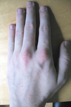 Back-a-my-hand sandwich