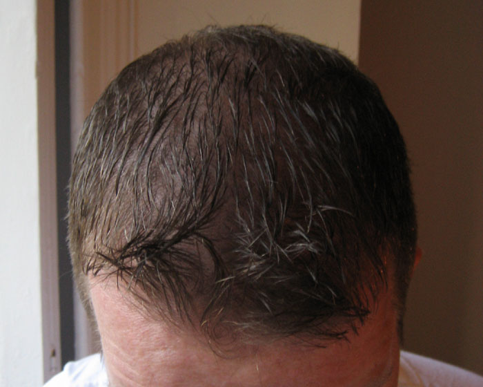 Hair Gel Is Verbotten